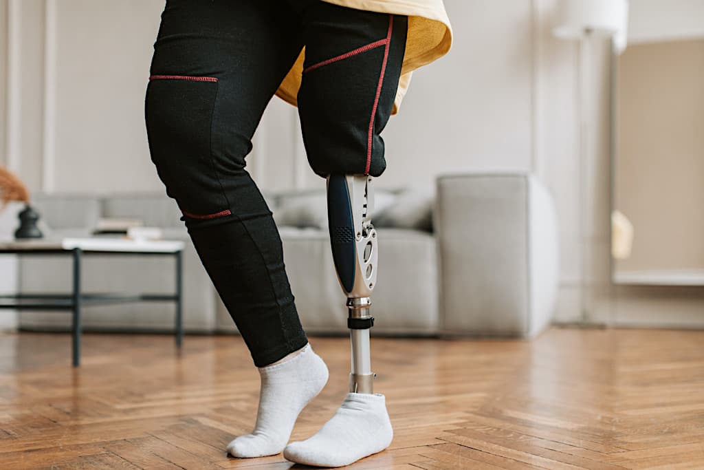 Vis et Deviens - un enfant portant une jambe robotisée