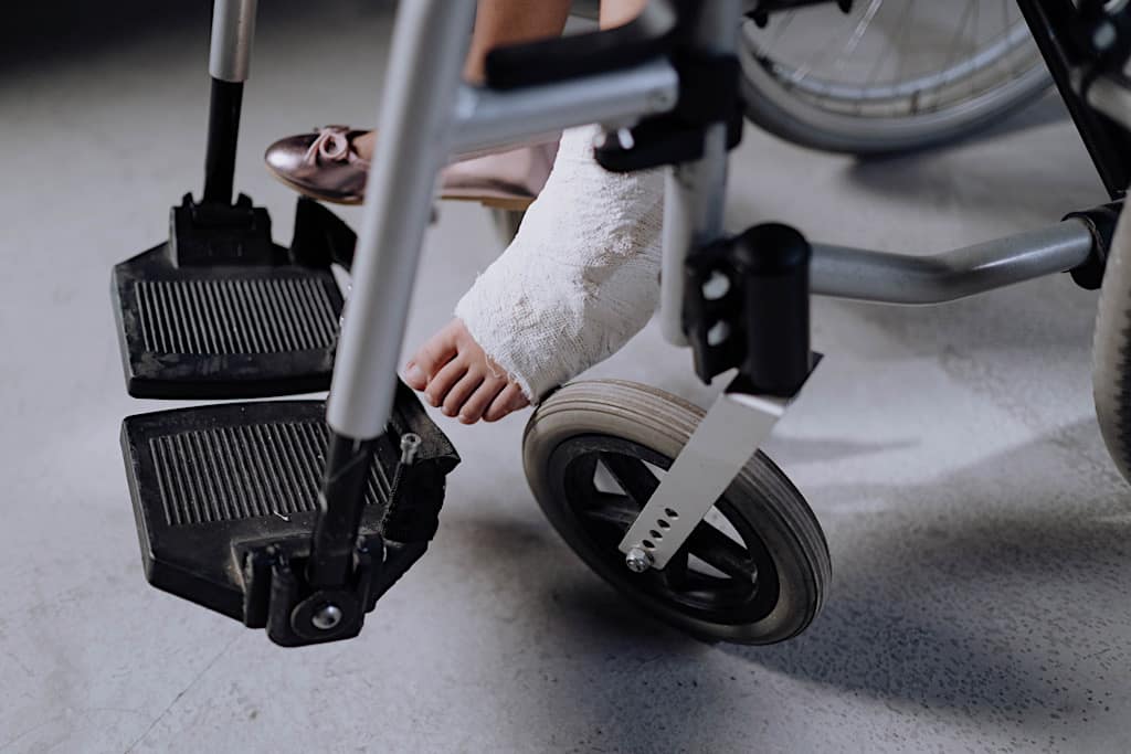 Vis et Deviens - Une petite fille assis sur un fauteuil roulant ayant un plâtre au pied.